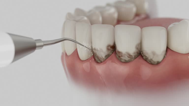Reliable Tooth Extraction contractor in Polk County County, TN by Dentist Open Now
